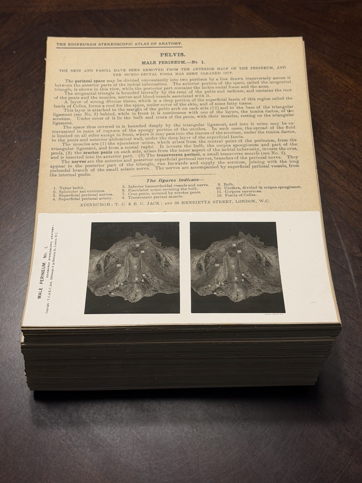 1909 The Edinburgh Stereoscopic Atlas of Anatomy, Section IV EXCELLENT CONDITION