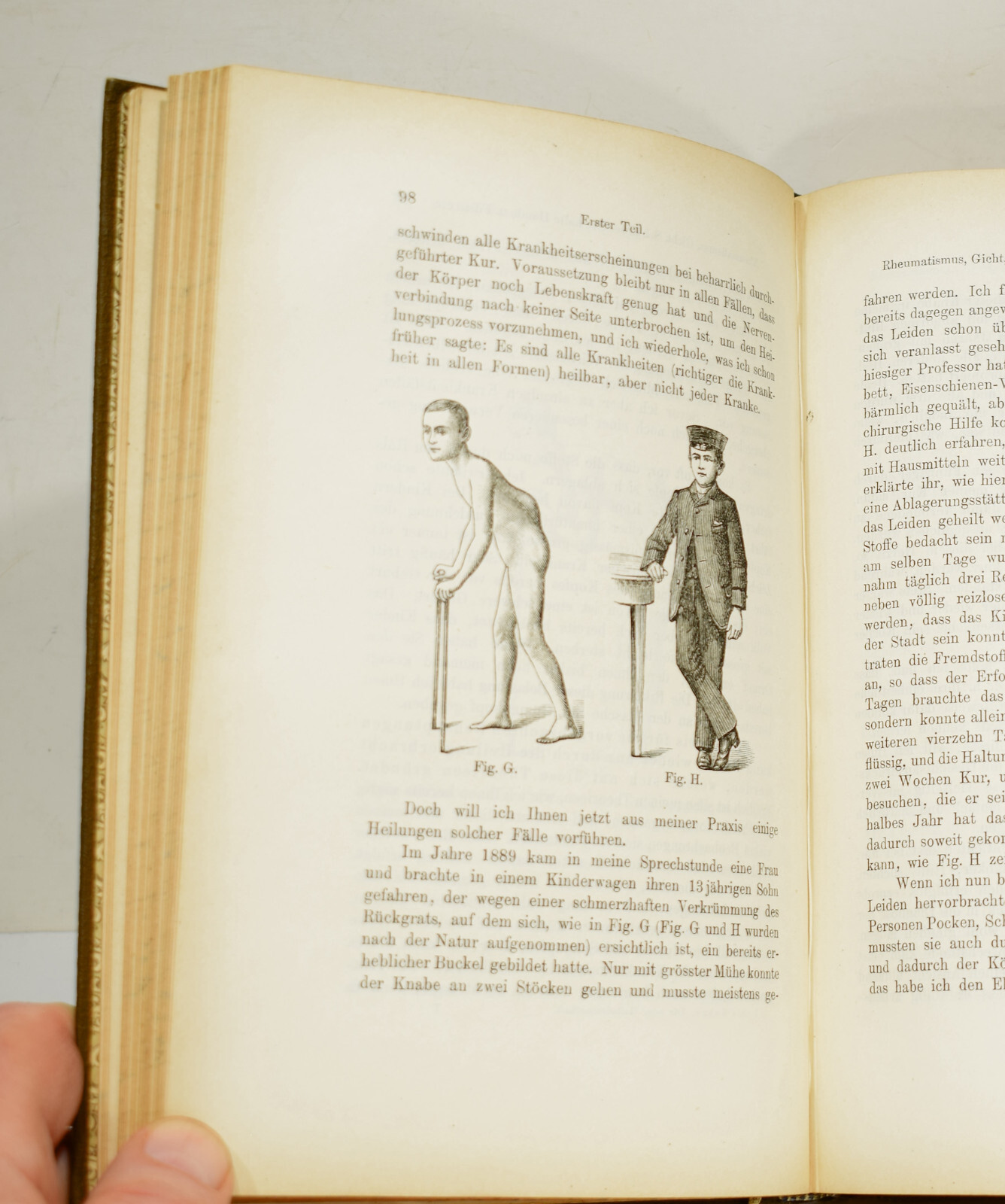DIE NEUE HEILWISSENSCHAFT by Louis Kuhne 1896 Early German Naturopathy Text