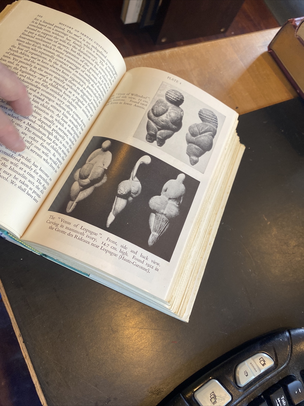 SEXUAL CUSTOMS : A HISTORY Richard Lewinsohn M.D. 1958 hcdj 1st U.S. Ed.
