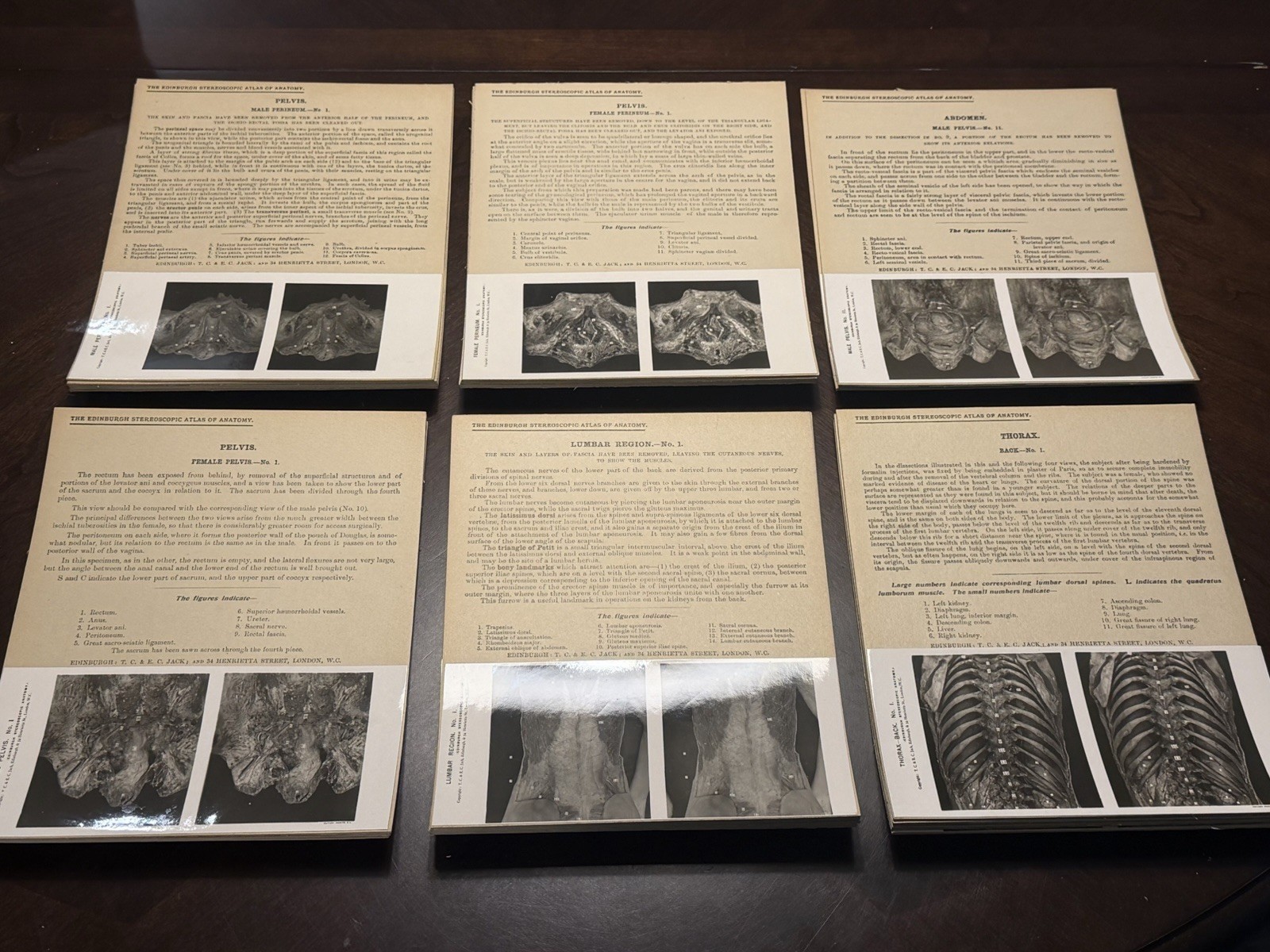 1909 The Edinburgh Stereoscopic Atlas of Anatomy, Section IV EXCELLENT CONDITION