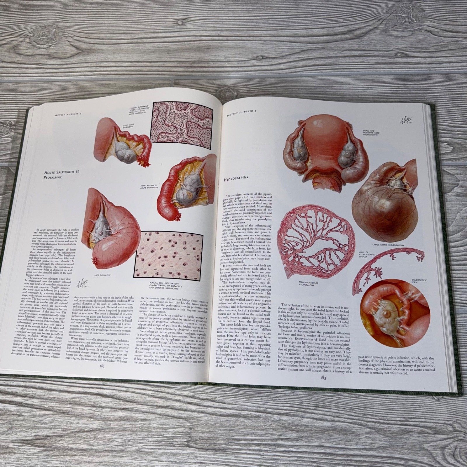 The CIBA Collection Of Medical Illustrations Vol 2 Reproductive System Netter