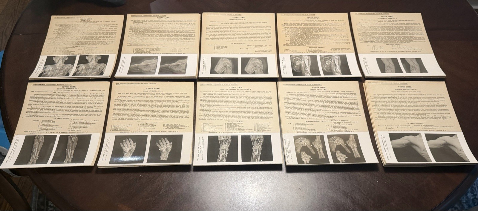 1909 The Edinburgh Stereoscopic Atlas of Anatomy, Section IV EXCELLENT CONDITION