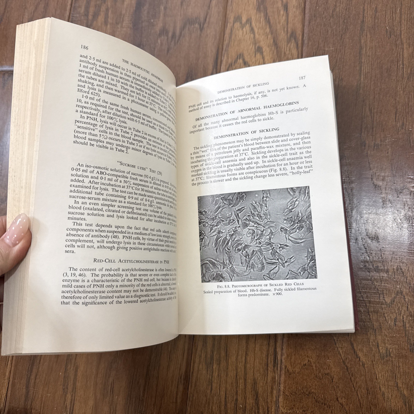 Practical Haematology Hardcover Book Dacie Lewis 4th Edition 1968