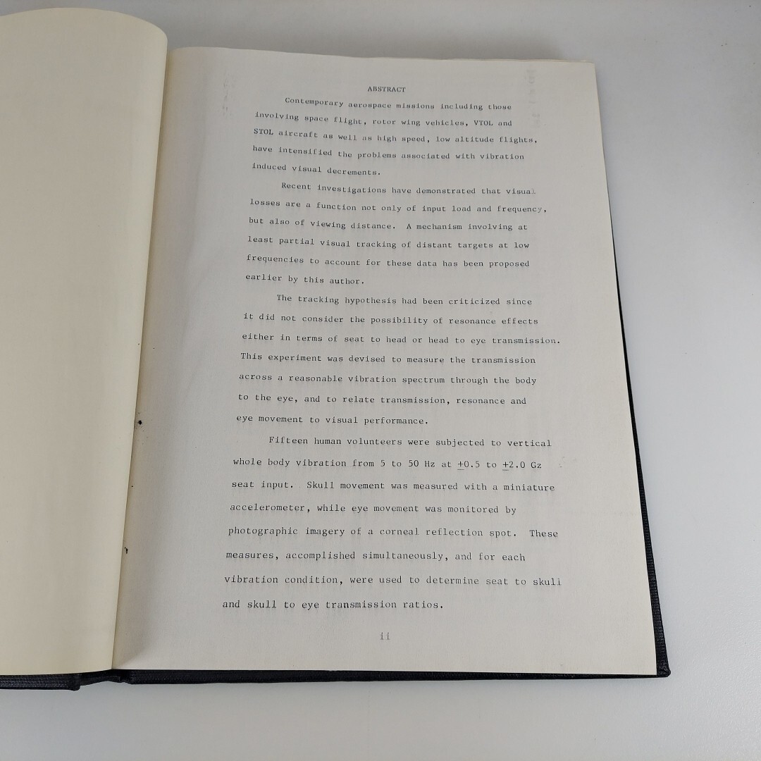 Bound PhD Thesis The Mechanical Resonant Frequency Of The Human Eye In Vivo HC