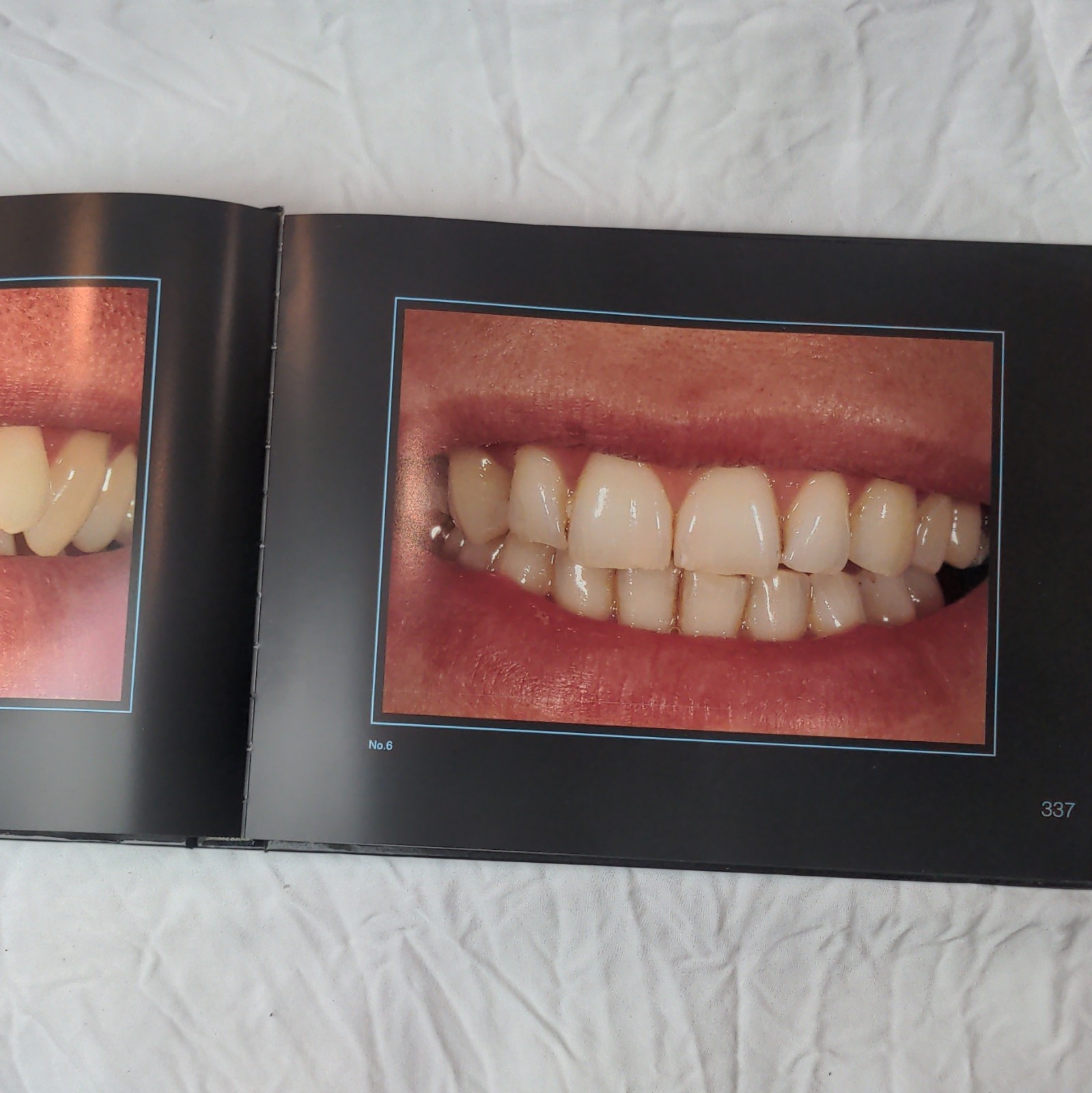 Gérald Ubassy Analysis: The New Way in Dental Communication HC Illus 1999 MEA