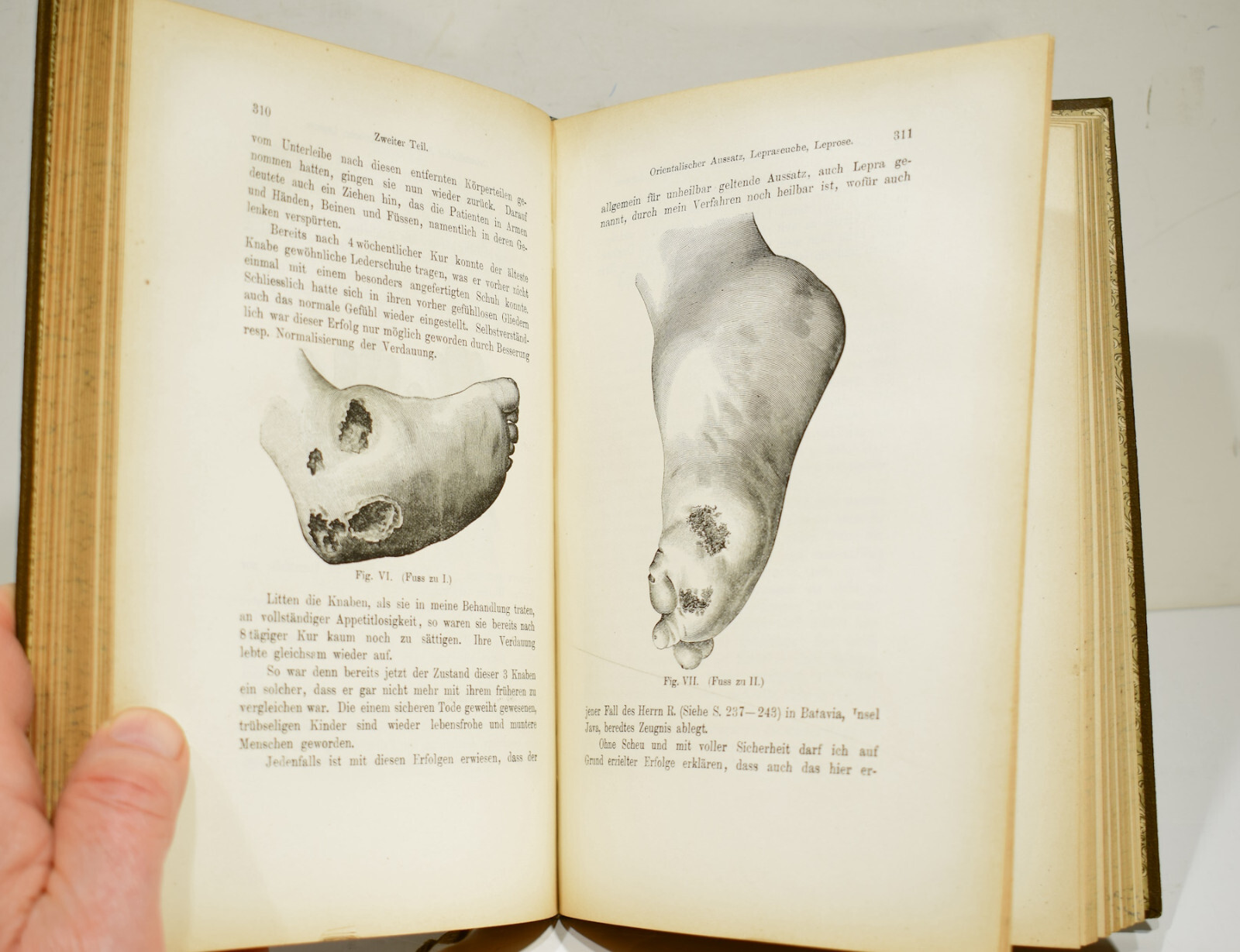 DIE NEUE HEILWISSENSCHAFT by Louis Kuhne 1896 Early German Naturopathy Text