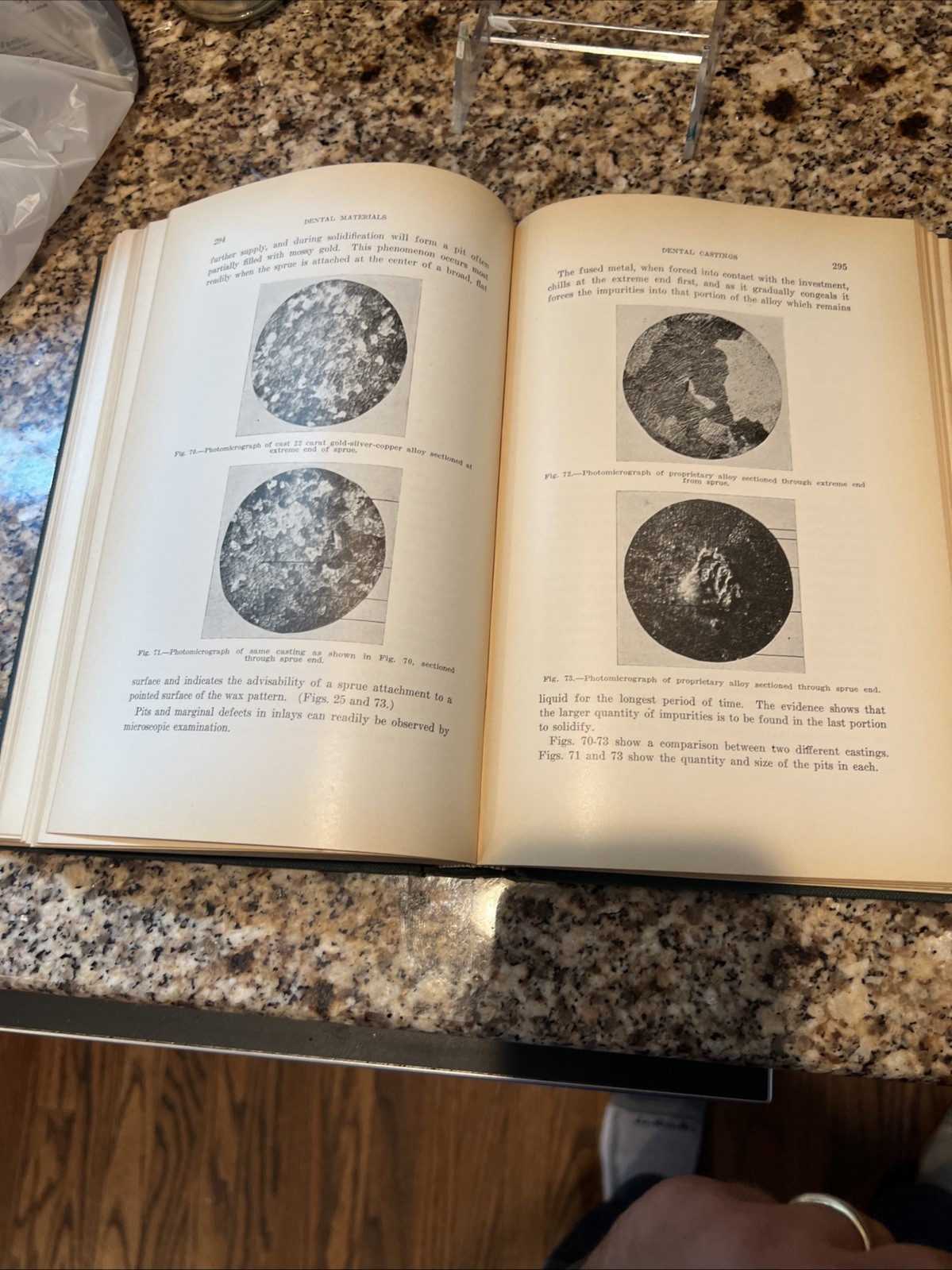 Hodgen-Shell DENTAL MATERIALS book hc 1938 JOHN S SHELL dentistry