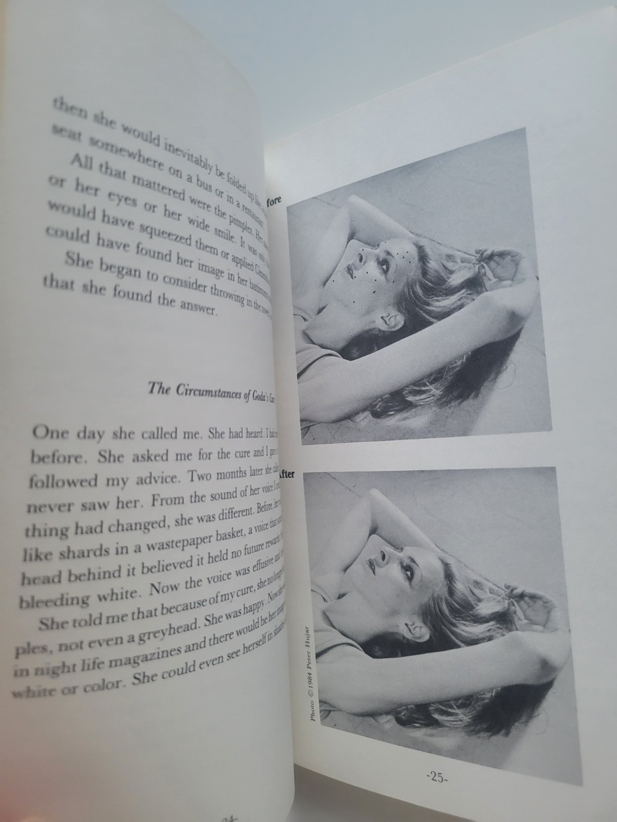 1984 HOW TO GET RID OF PIMPLES COOKIE MUELLER TOP SHORT STORIES PAPERBACK RARE