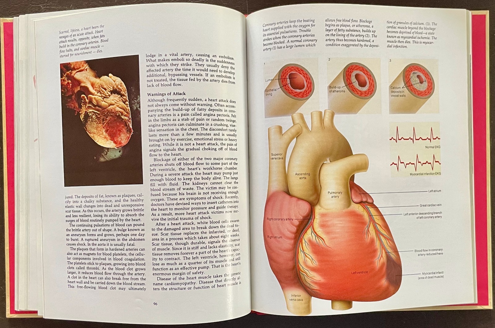 THE HUMAN BODY Complete Set. Vol 1-20. 1985. Torstar. Good Condition