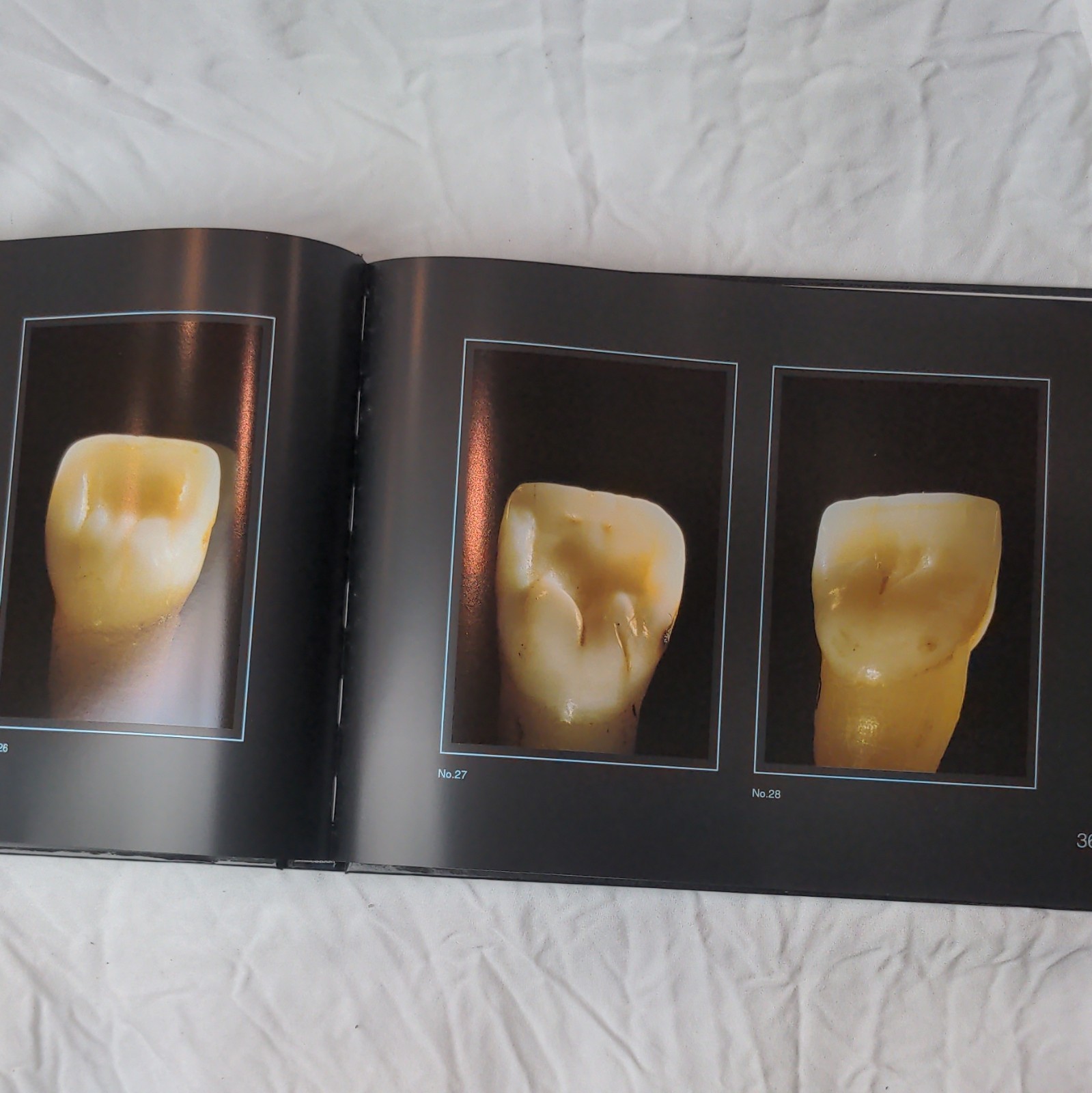 Gérald Ubassy Analysis: The New Way in Dental Communication HC Illus 1999 MEA