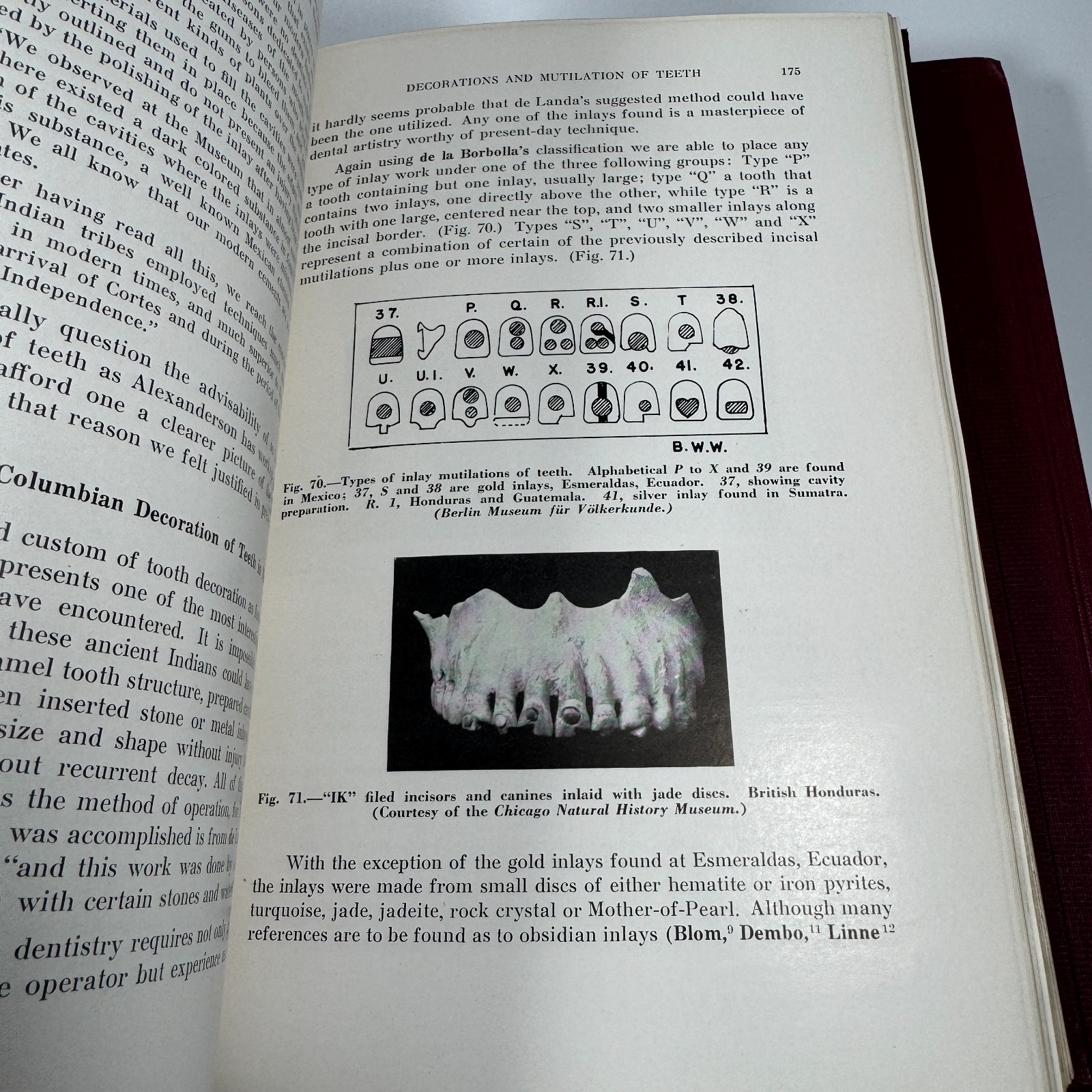 History of Dentistry Vol 1 & 2 Hardcover by Bernhard Weinberger 1948 CV Mosby Co