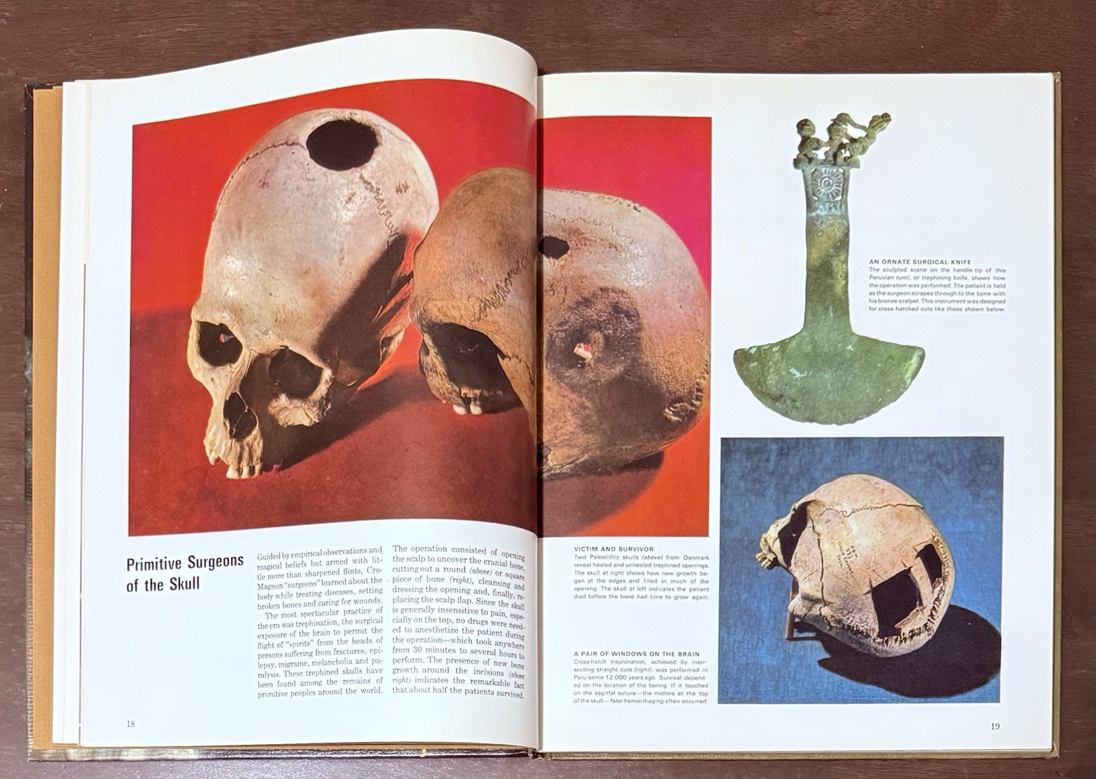 The Body by Alan E. Nourse, Time Life Science Library. Entertaining To Read Look