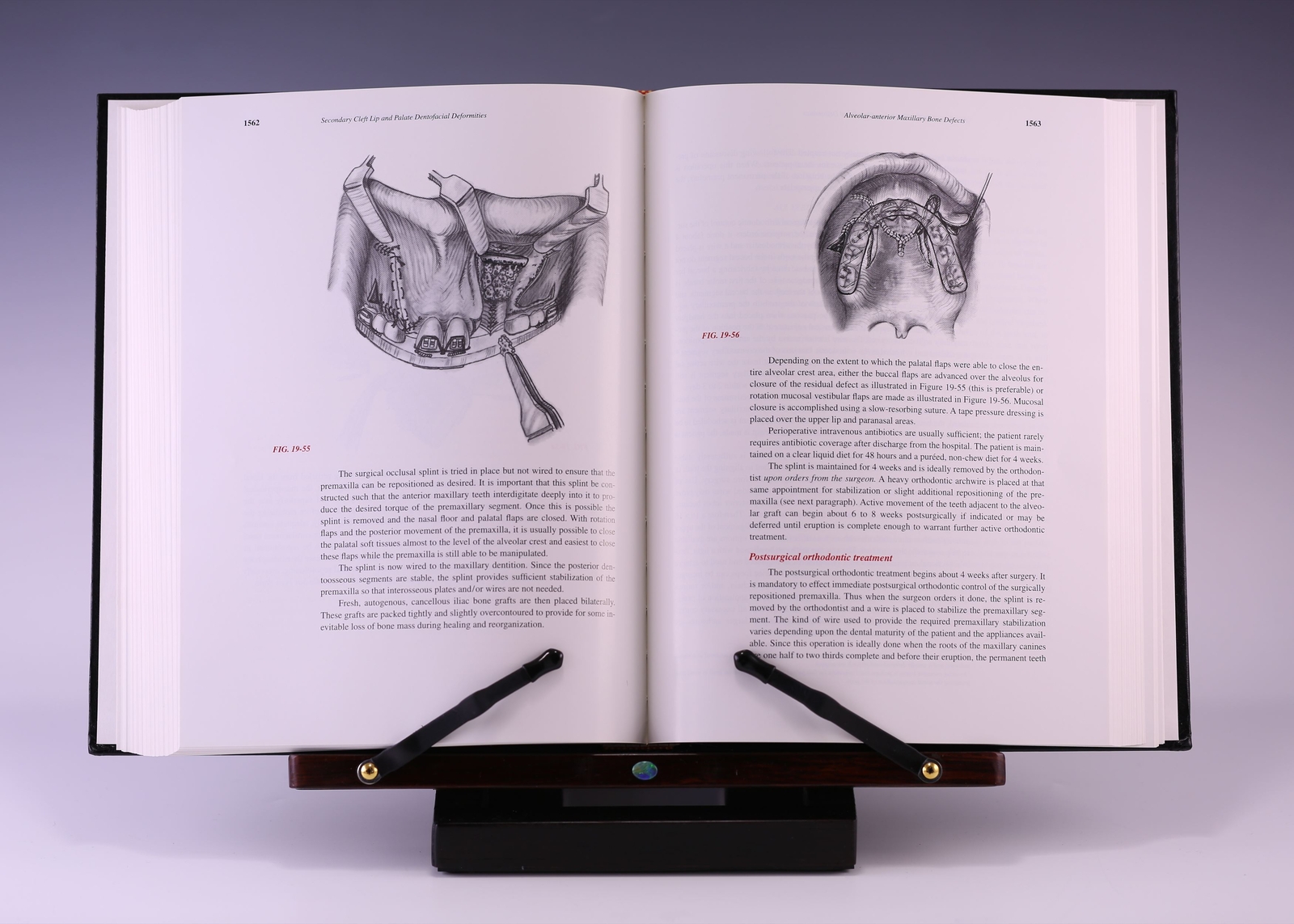 Dentofacial Deformities: Volume III; 2nd Ed by Bruce N. Epker DDS PhD, et al.