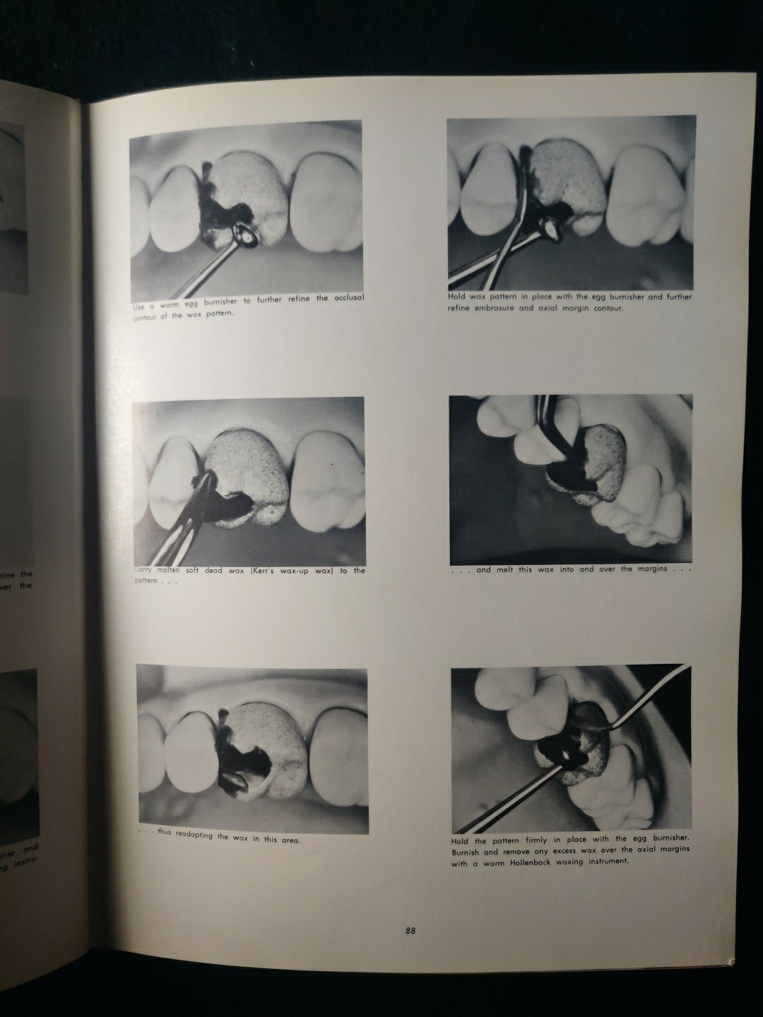 An Atlas of Cast Gold Procedures 1969 Revision Operative Atlas II Dentistry