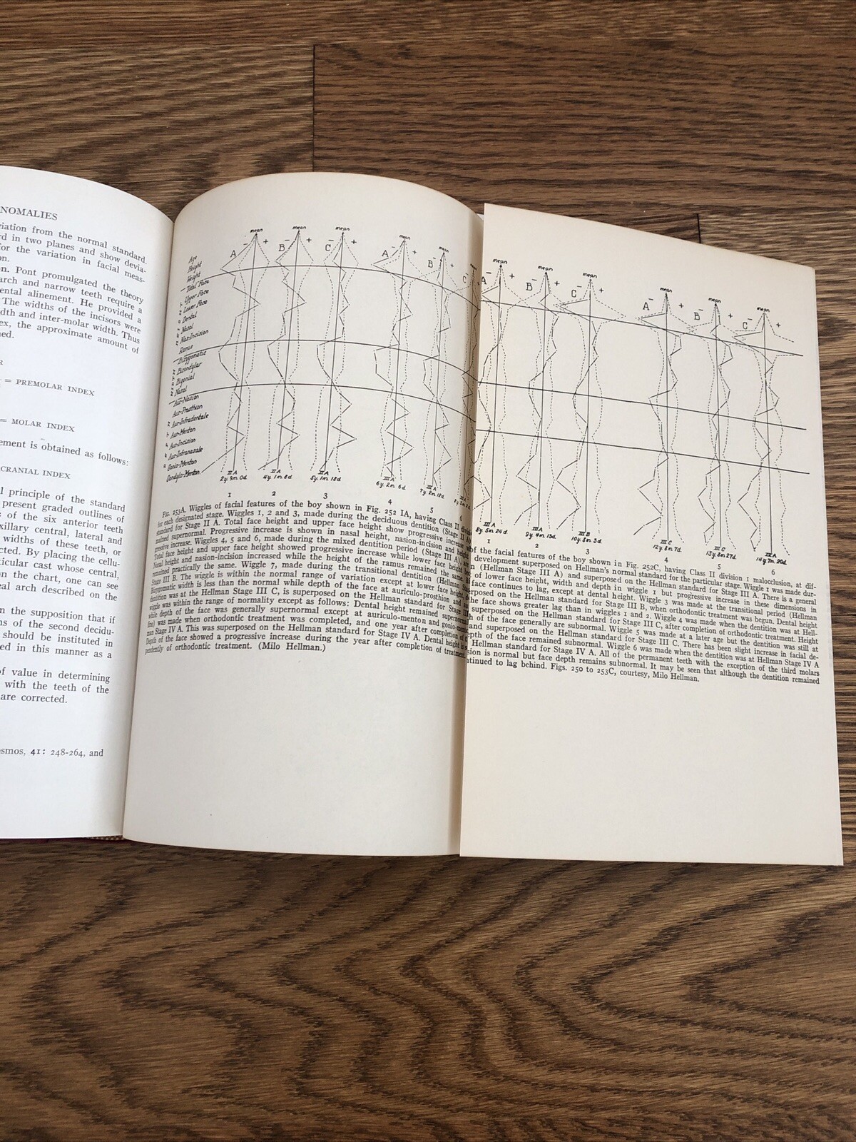 Principles of Orthodontics Salzmann DDS 1943 Illustrated Charts Dentistry HC