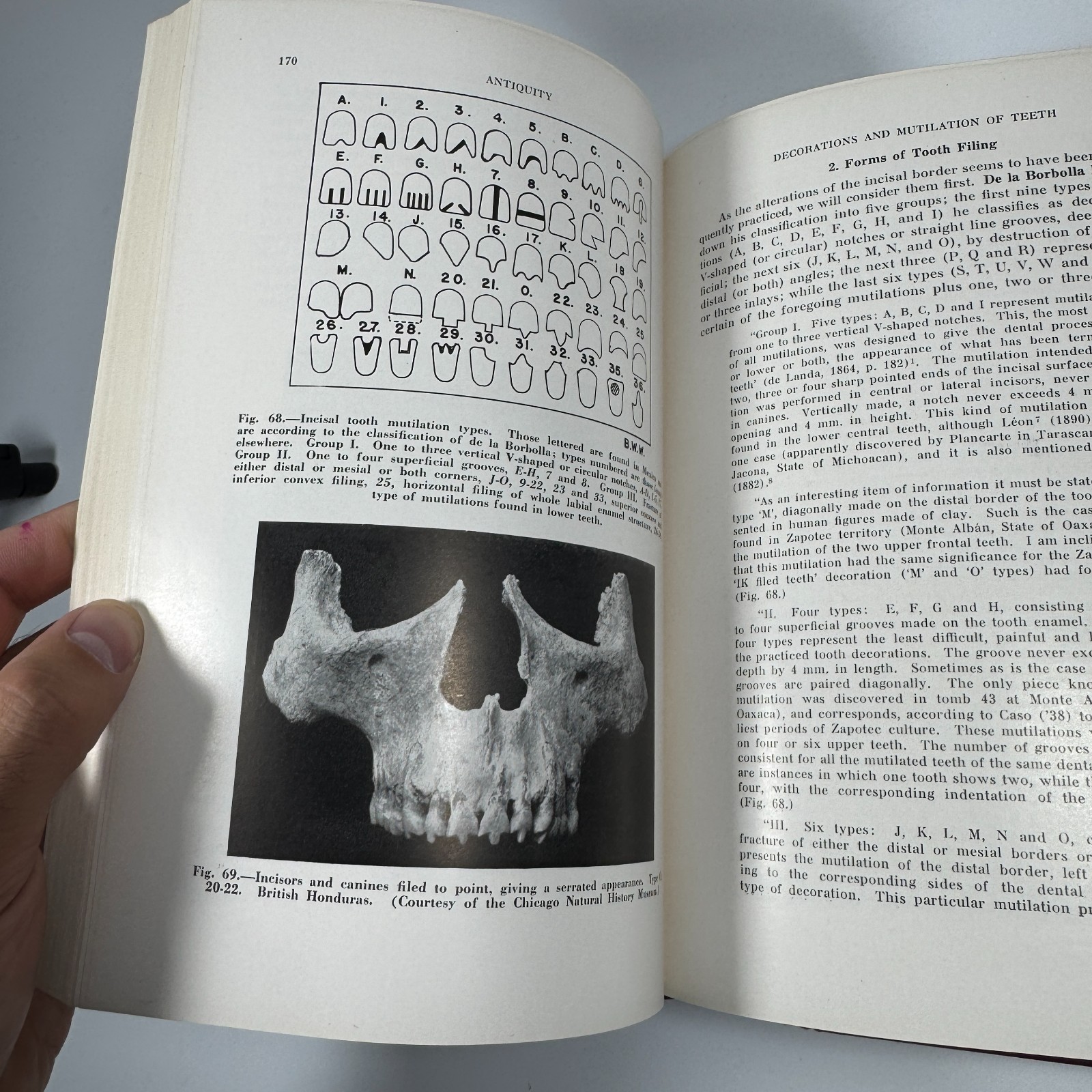 History of Dentistry Vol 1 & 2 Hardcover by Bernhard Weinberger 1948 CV Mosby Co