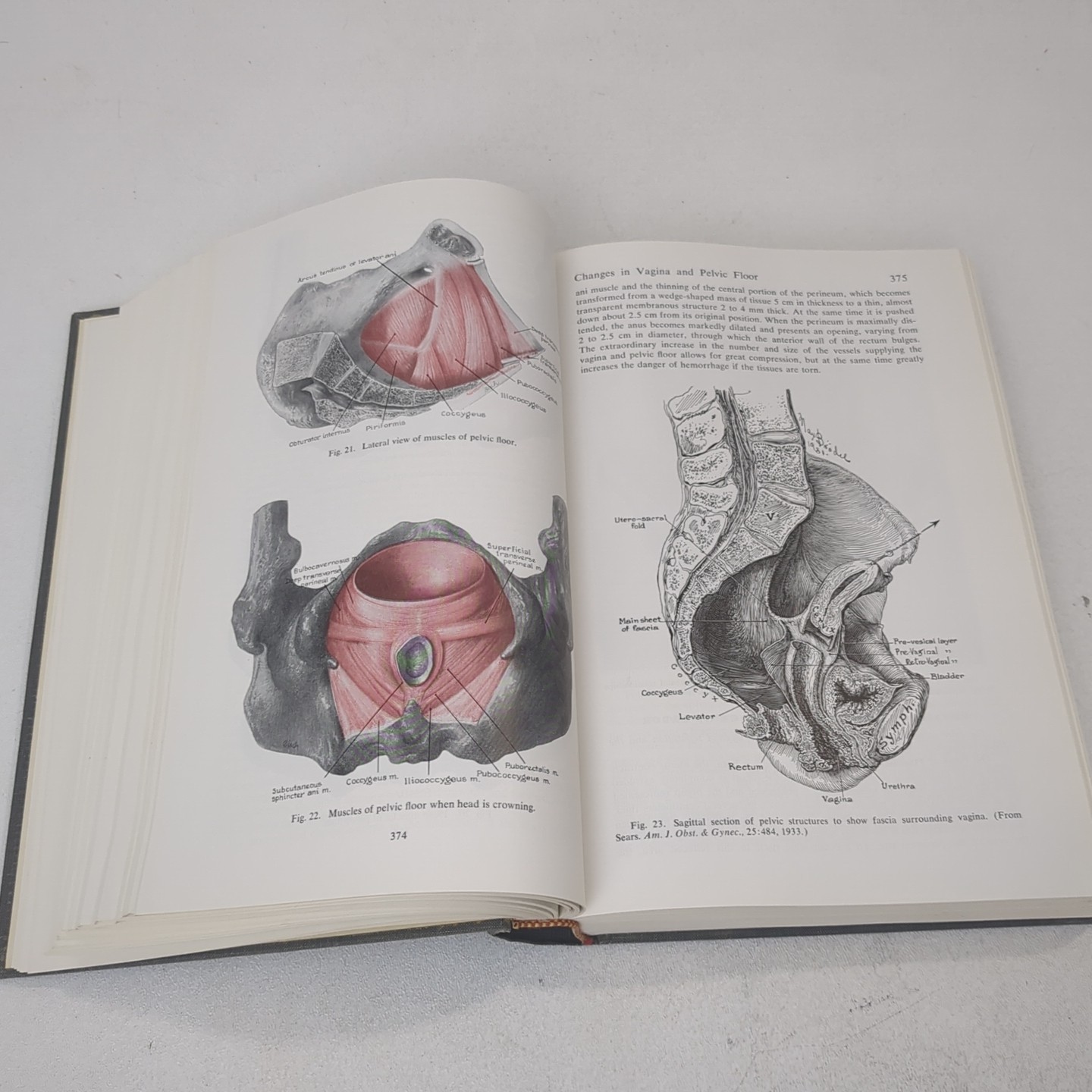 Williams Obstetrics Thirteenth 13th Edition Nicholson Eastman Louis Hellman 1966