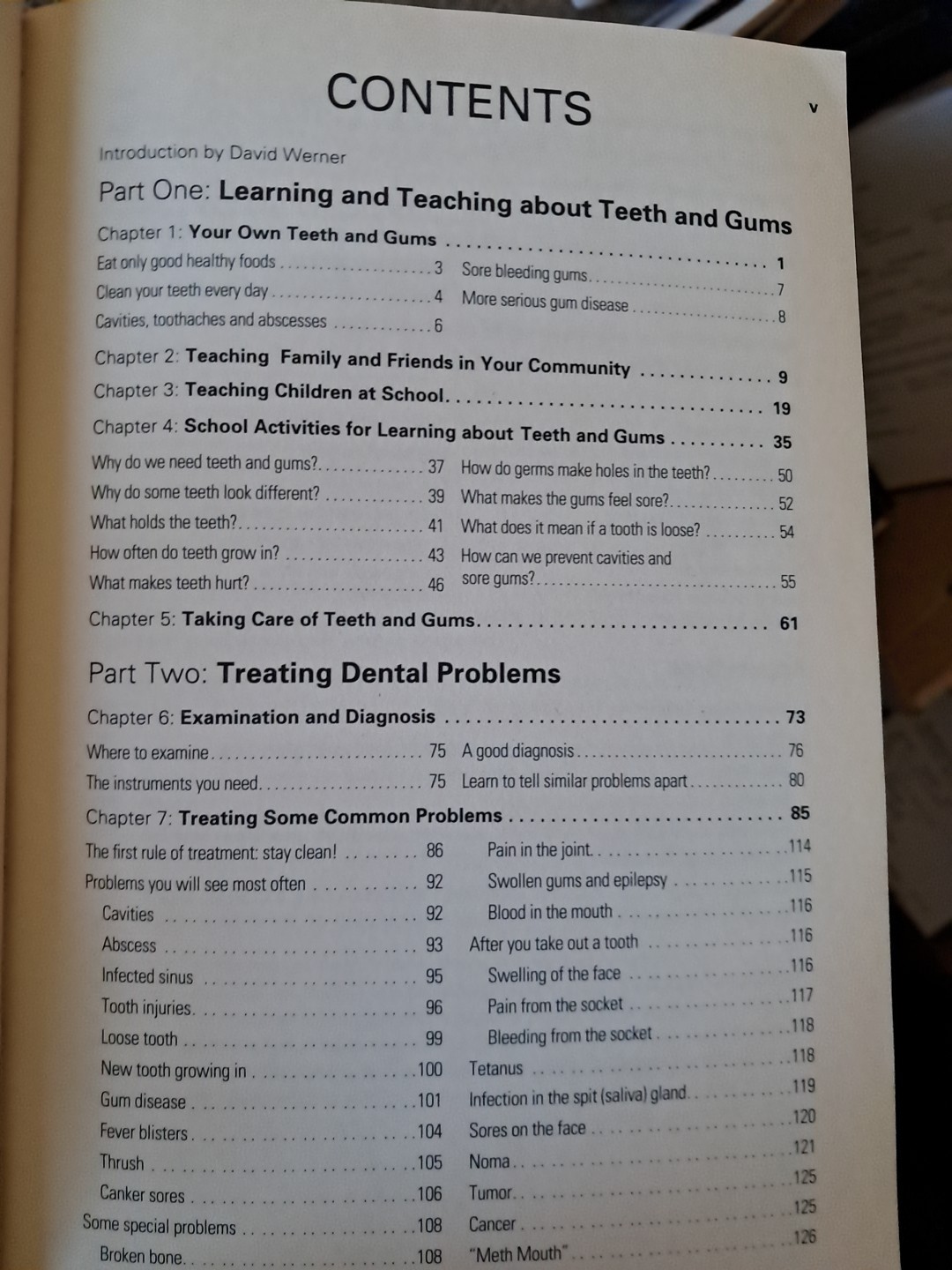 When There is No Dentist by Murray Dickson