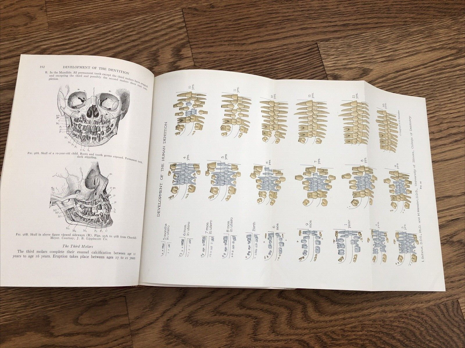 Principles of Orthodontics Salzmann DDS 1943 Illustrated Charts Dentistry HC