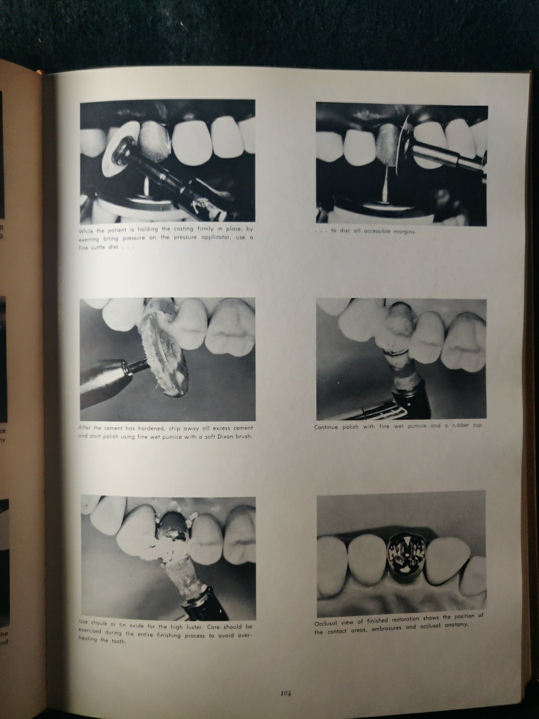An Atlas of Cast Gold Procedures 1969 Revision Operative Atlas II Dentistry