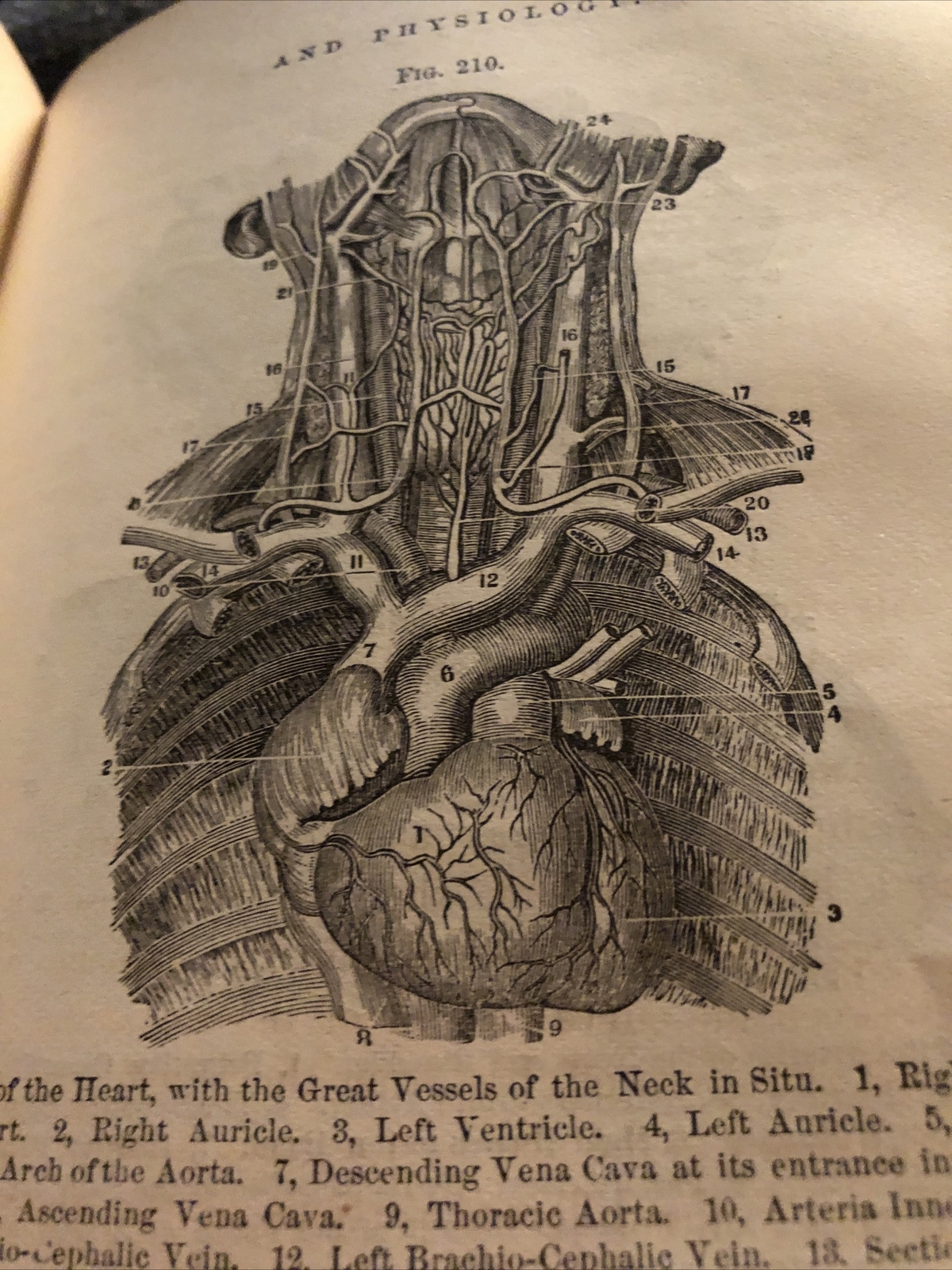 1875 Elementary Anatomy by Hitchcock black Hardback illust. 435 Pages w/index