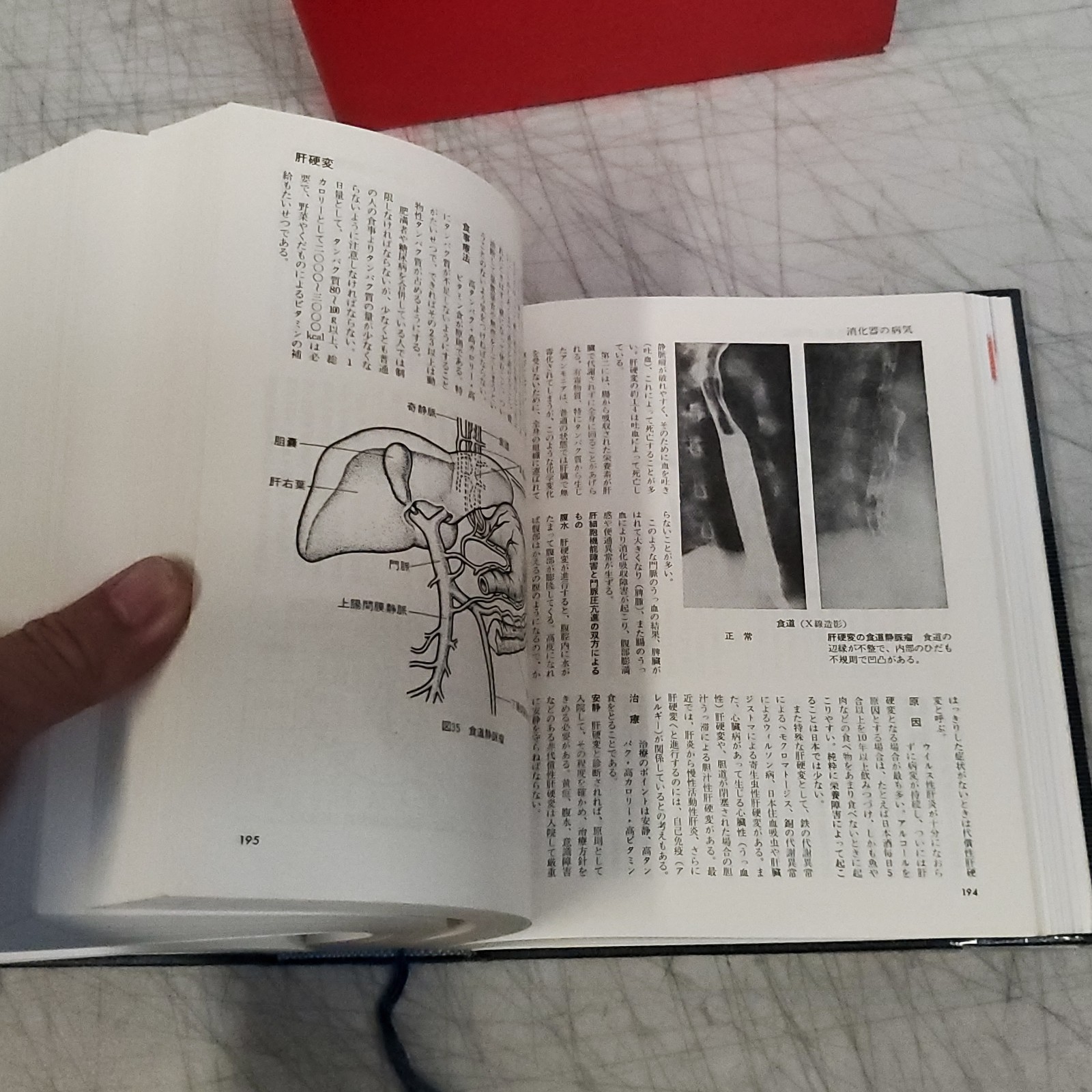 Vintage Japanese Modern Family Medicine Encyclopedia Shufunotomosha (家庭医学 百科)