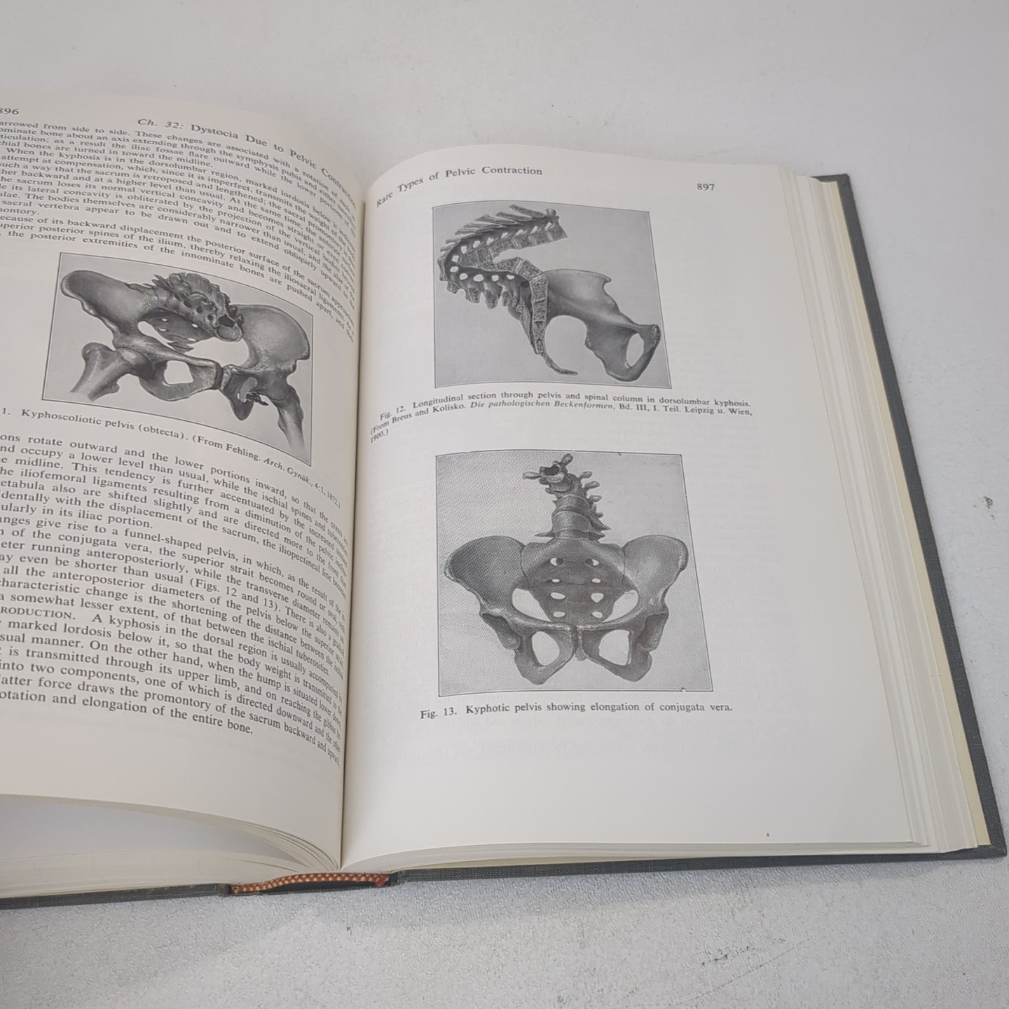 Williams Obstetrics Thirteenth 13th Edition Nicholson Eastman Louis Hellman 1966