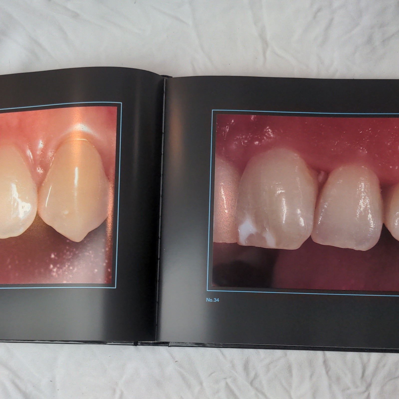 Gérald Ubassy Analysis: The New Way in Dental Communication HC Illus 1999 MEA