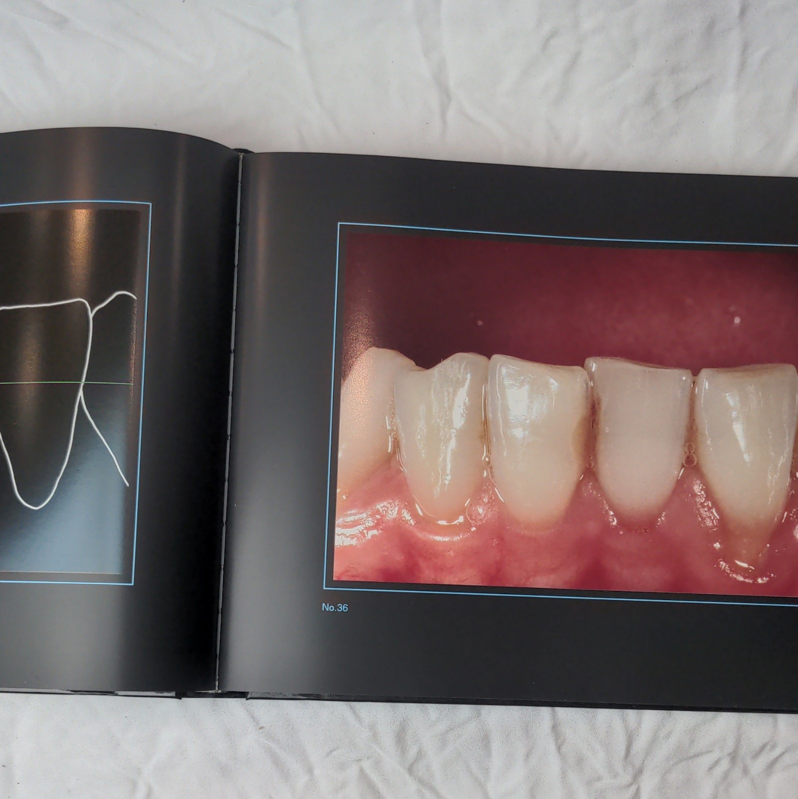 Gérald Ubassy Analysis: The New Way in Dental Communication HC Illus 1999 MEA