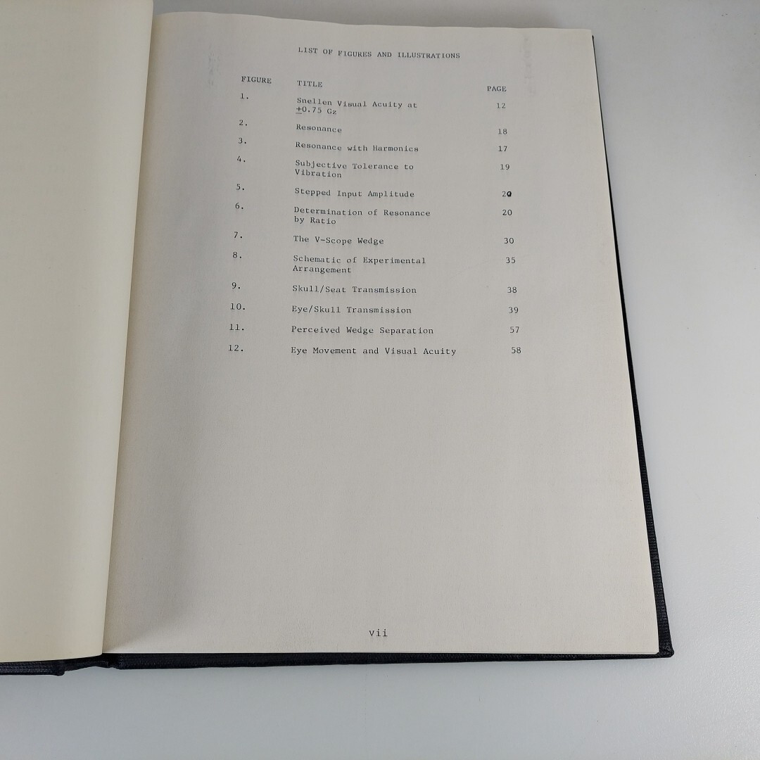 Bound PhD Thesis The Mechanical Resonant Frequency Of The Human Eye In Vivo HC