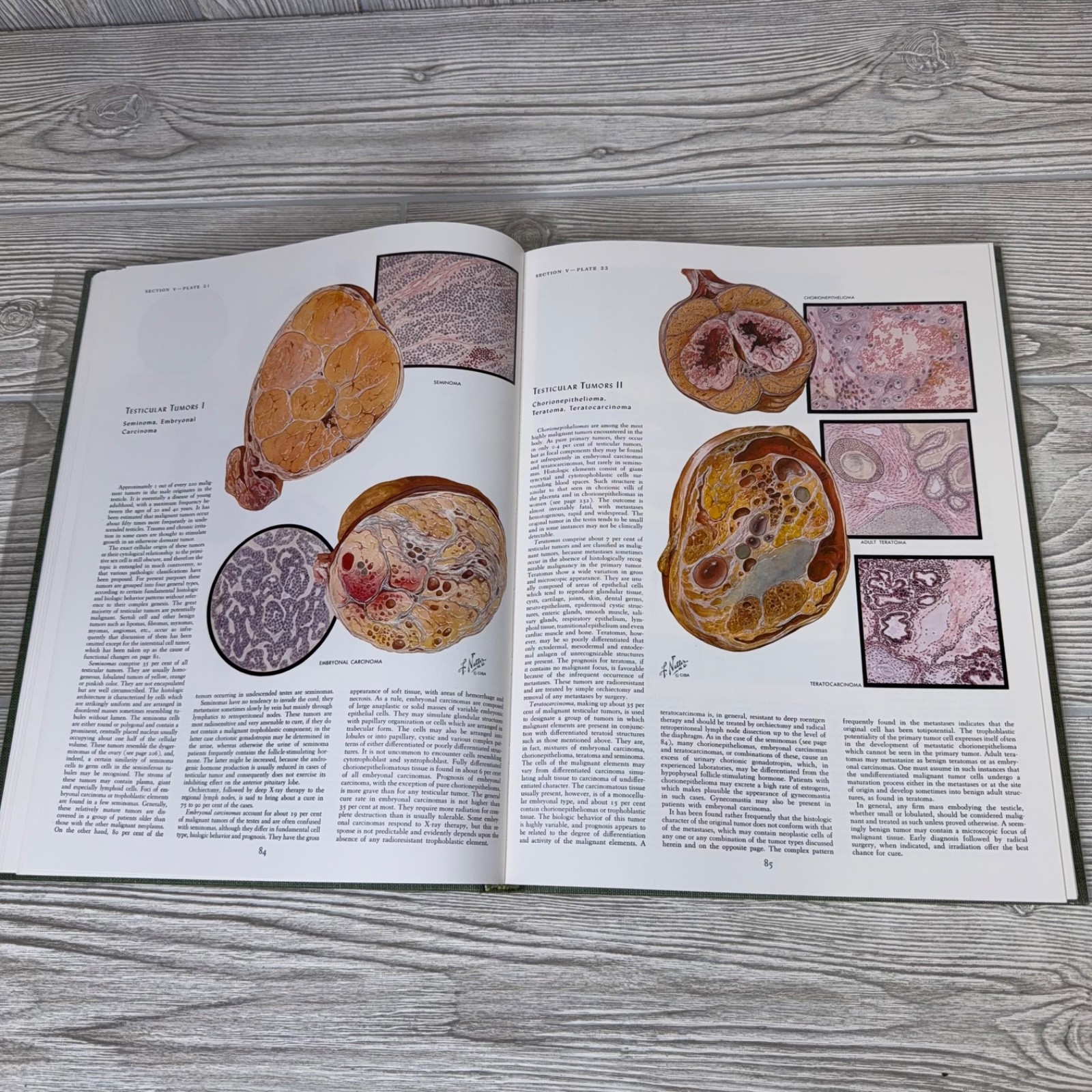 The CIBA Collection Of Medical Illustrations Vol 2 Reproductive System Netter