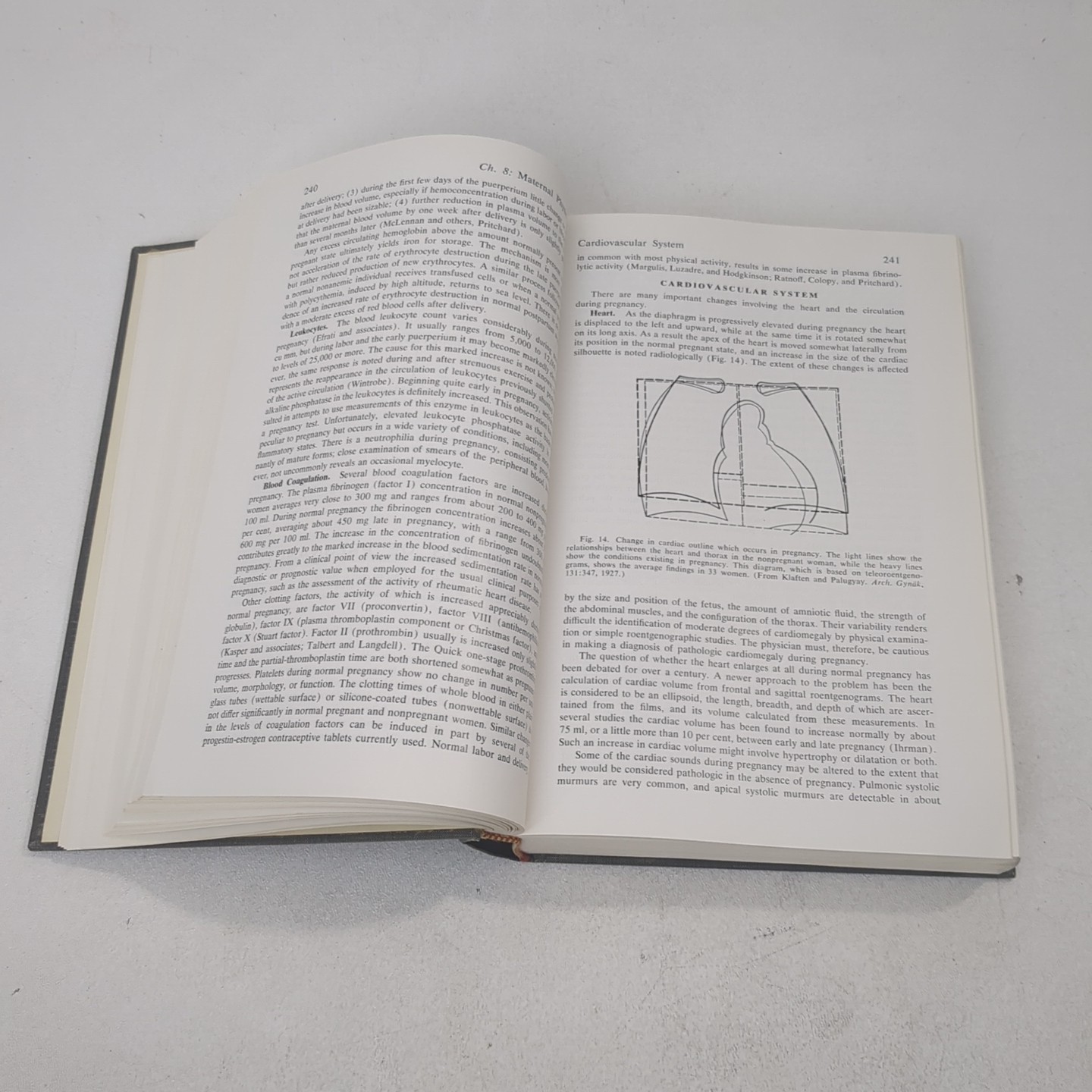 Williams Obstetrics Thirteenth 13th Edition Nicholson Eastman Louis Hellman 1966