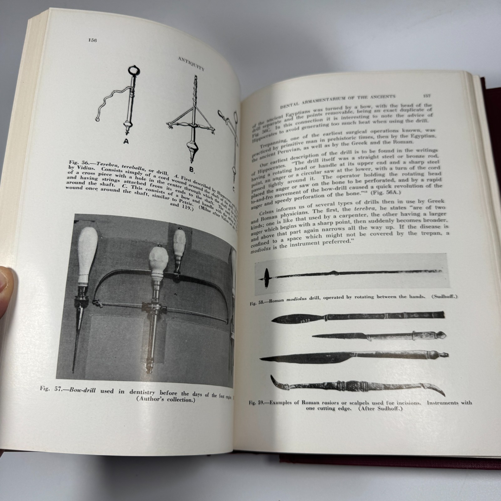 History of Dentistry Vol 1 & 2 Hardcover by Bernhard Weinberger 1948 CV Mosby Co