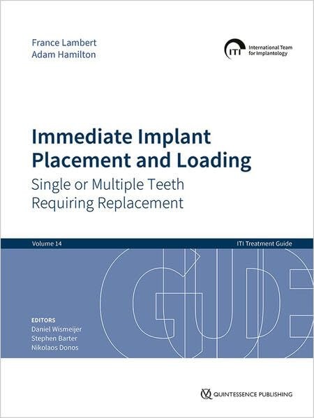 Immediate Implant Placement and Loading: Single or Multiple Teeth Requiring …
