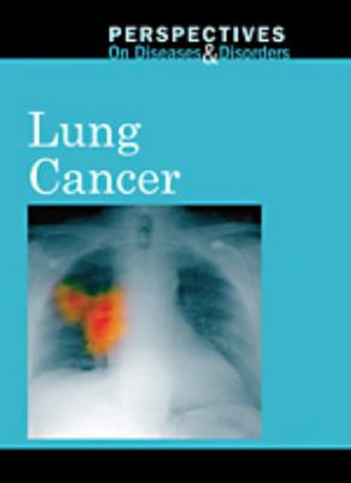 Lung Cancer Hardcover