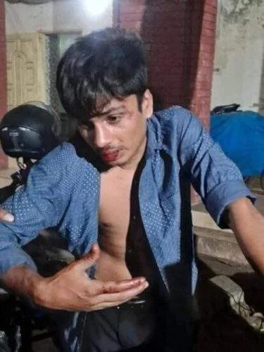 A photo of Rahid Khan Pavel lying in a hospital bed at Dhaka Medical College, with visible bruising and bandages, alongside a screenshot of a commemorative Facebook post about March 7.